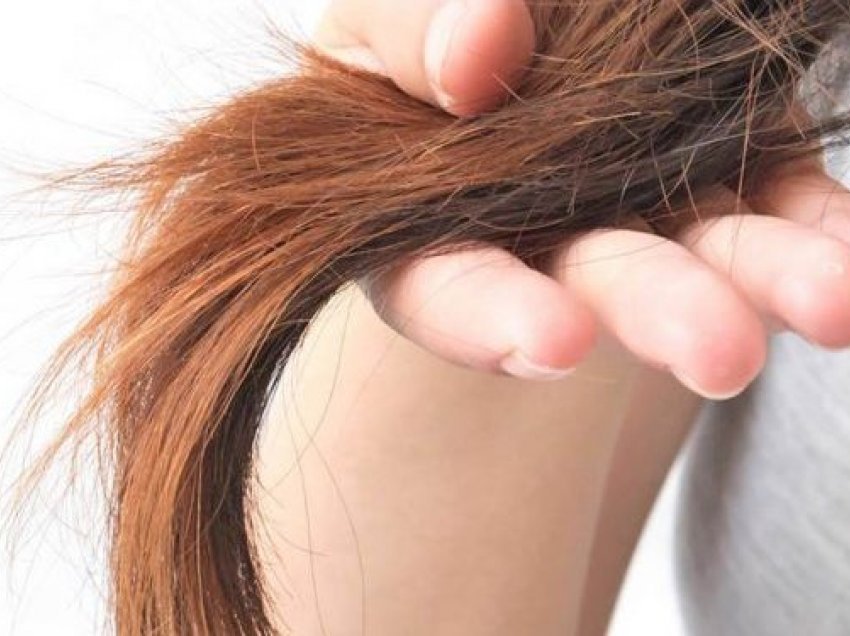 ​Rënia e flokëve, shenjë e një sëmundjeje të rëndë?