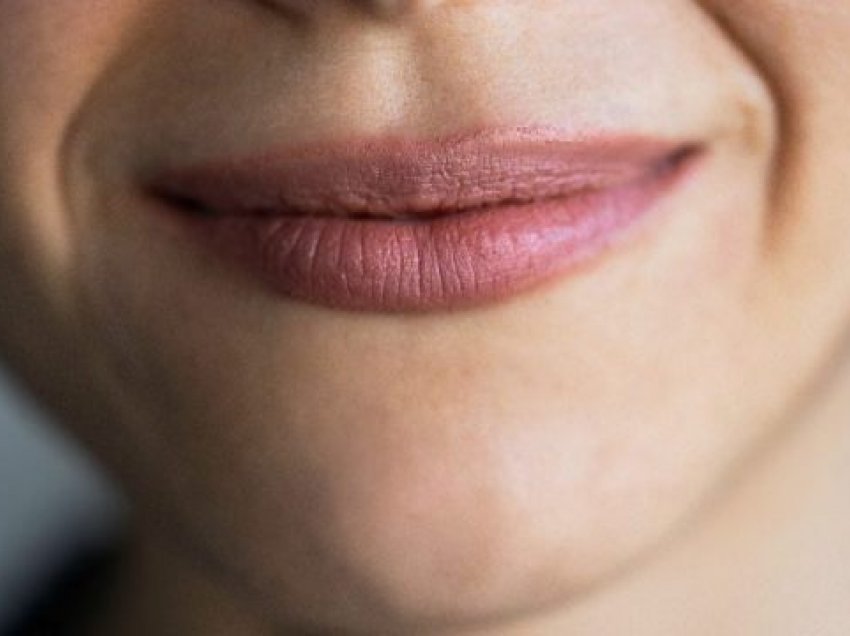 Kjo shenjë në cepin e buzëve tregon mungesë të vitaminës B12