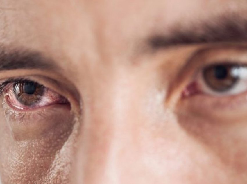 Infektimi nga Covid-19 – Pse duhet të mbroni sytë?