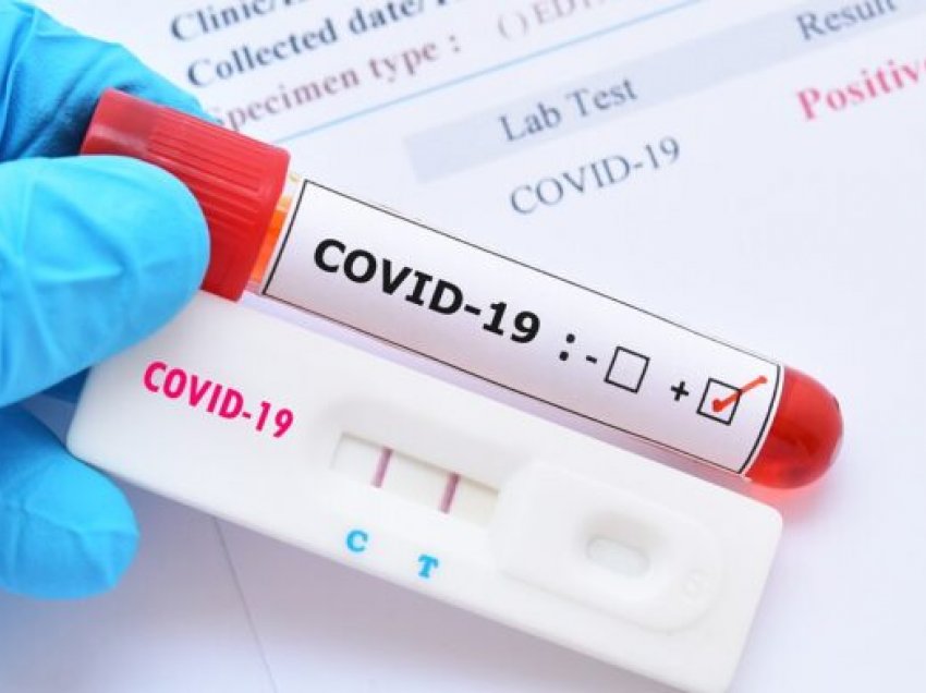 74 raste aktive me COVID-19 në Malishevë