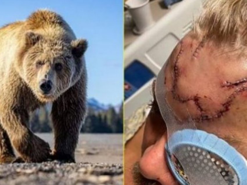 Moment i tmerrshëm: Burri rrëfen se si mbijetoi pas luftës me ariun në një pjesë të pyllëzuar
