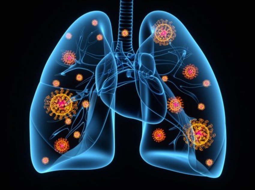 Pneumonia: Pesë shenja paralajmëruese që mushkëritë po dëmtohen nga COVID-19
