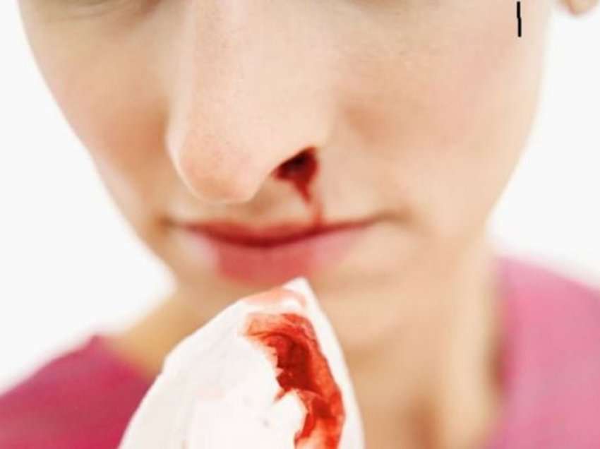 Gjak nga hundët? Çfarë sëmundjesh paralajmëron