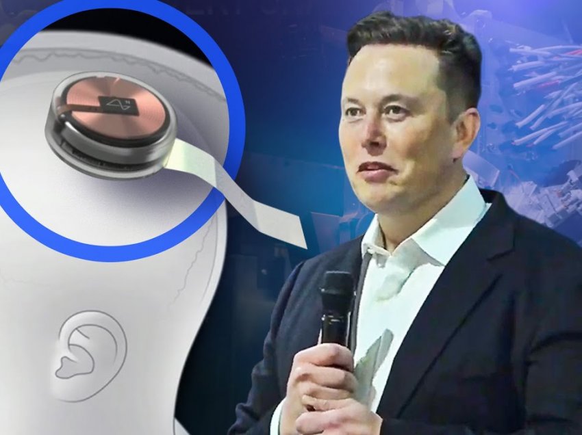 Kompania e Elon Musk së shpejti fillon testimin e vendosjes së çipave në trurin e njeriut