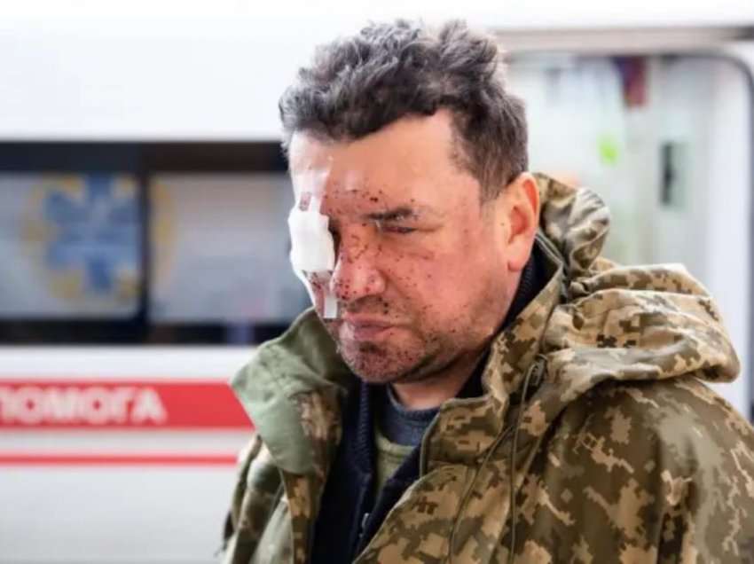 Heronjtë e përgjakur/Rrëfimi i kolonelit ukrainas që i shpërtheu predha ruse në fytyrë