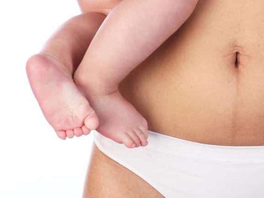 Ndryshimet e trupit pas lindjes: Diastaza abdominale