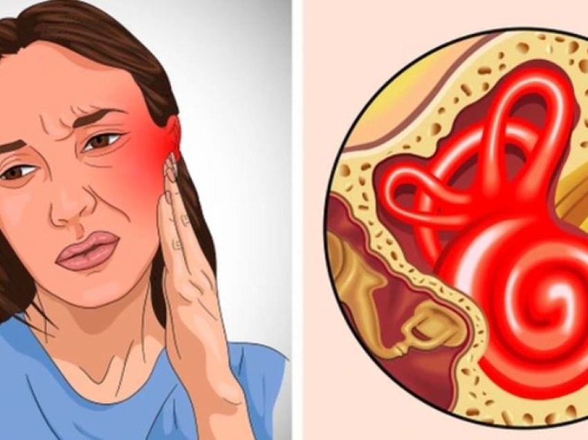 6 shenja që tregojnë se keni infeksion të veshit