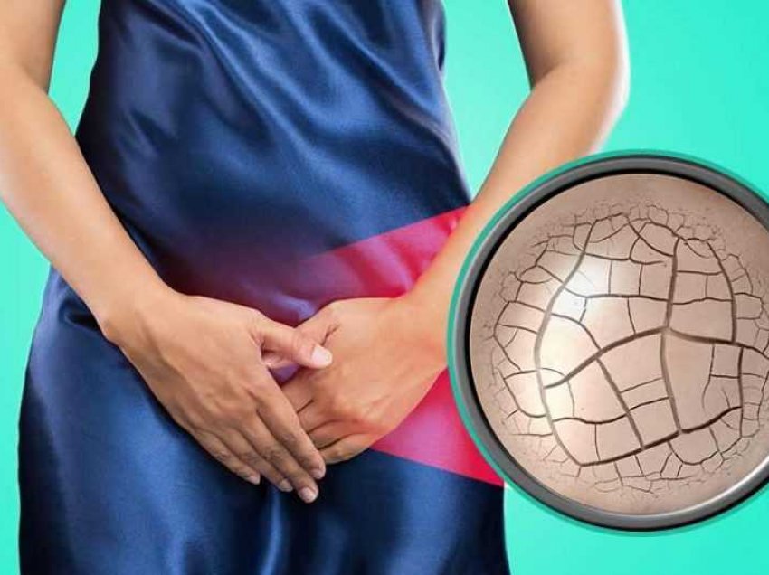5 gjërat që mund të shkaktojnë thatësi vaginale
