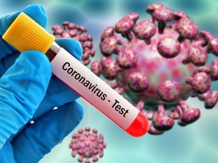 32 raste të reja me koronavirus regjistrohen në zonat e banuara me serbë