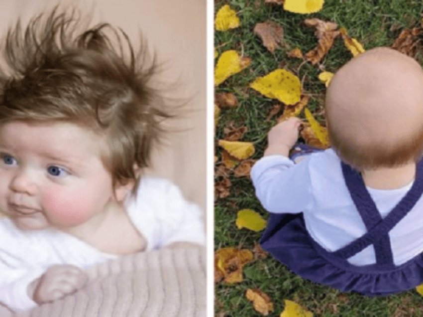 Pse disa fëmijë lindin me pak e disa tjerë me shumë flokë?