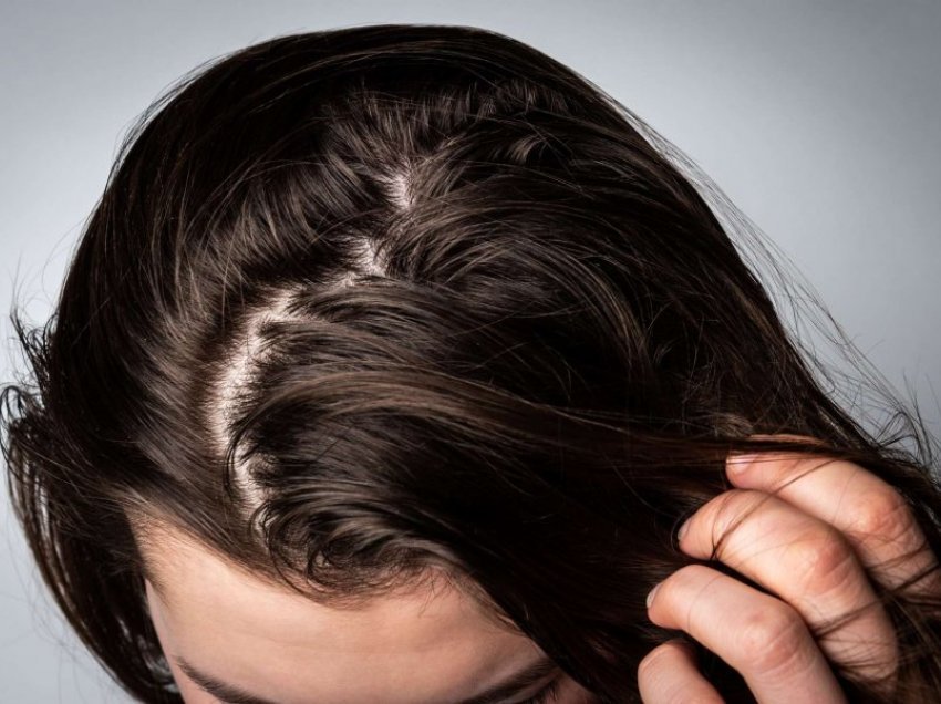 10 këshilla si të largoni një herë e mirë yndyrën nga flokët