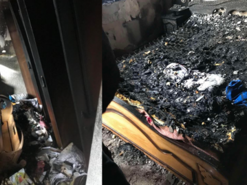 Vdes 3-vjeçari nga Ferizaji që pësoi djegie të rënda nga zjarri
