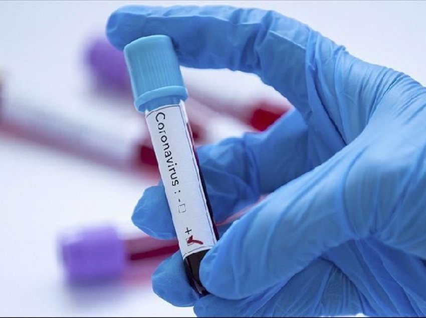 Bien rastet e reja me koronavirus/ Ministria e Shëndetësisë: Në 24 orë humbën jetën 12 persona