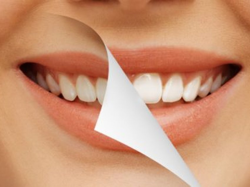 Çfarë nuk duhet të bëni, nëse doni të keni dhëmbë të bardhë?