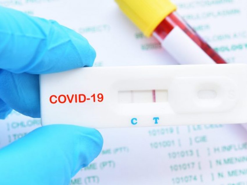 Sot 725 raste të reja, gjithsej mbi 100 mijë të infektuar me COVID-19 në Maqedoni