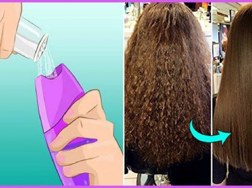 Hidhni 2 lugë kripë në shampo dhe shpëtoni nga ky problem i bezdisshëm për shumë vajza