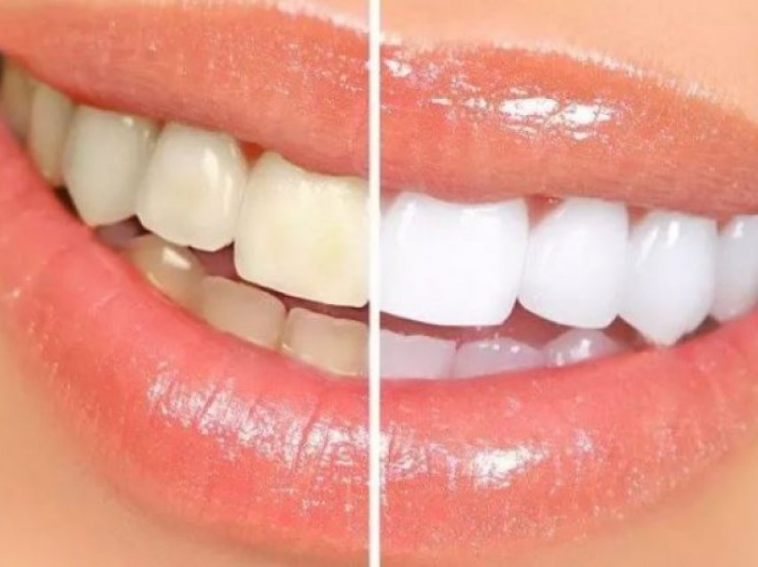 2 përgatitje që nuk kushtojnë për dhëmbë të bardhë