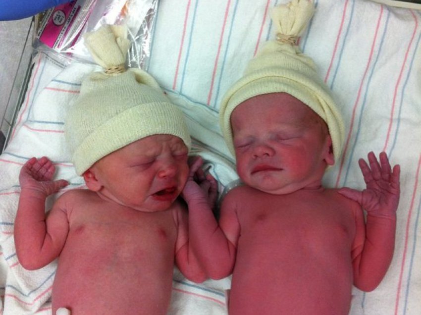 Arsyet përse fëmijët binjakë lindin më herët se koha e përcaktuar