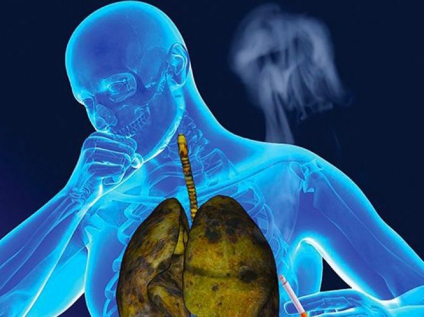 Kolla e duhanit – Kur sinjalizon rrezik për jetën?
