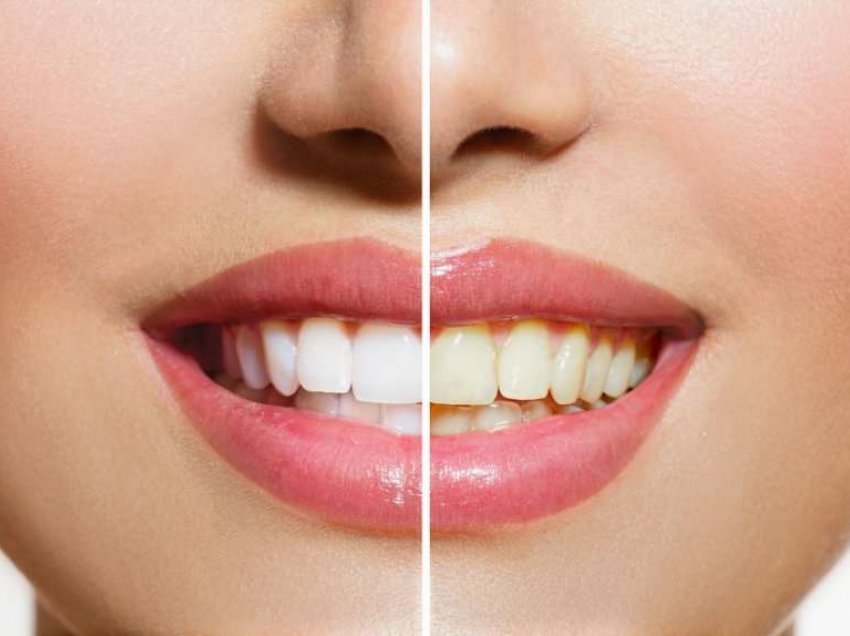 Ekspertët kanë zbuluar se çfarë ndodh nëse nuk lani dhëmbët për një muaj
