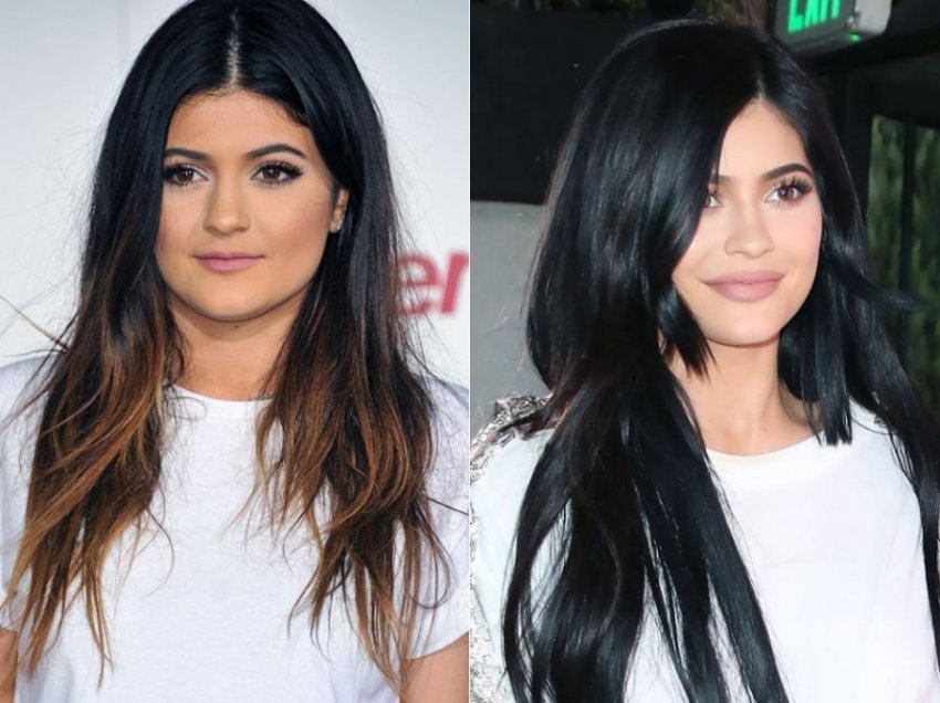 15 vite personazh publik, ja si ka ndryshuar pamja e Kylie Jenner