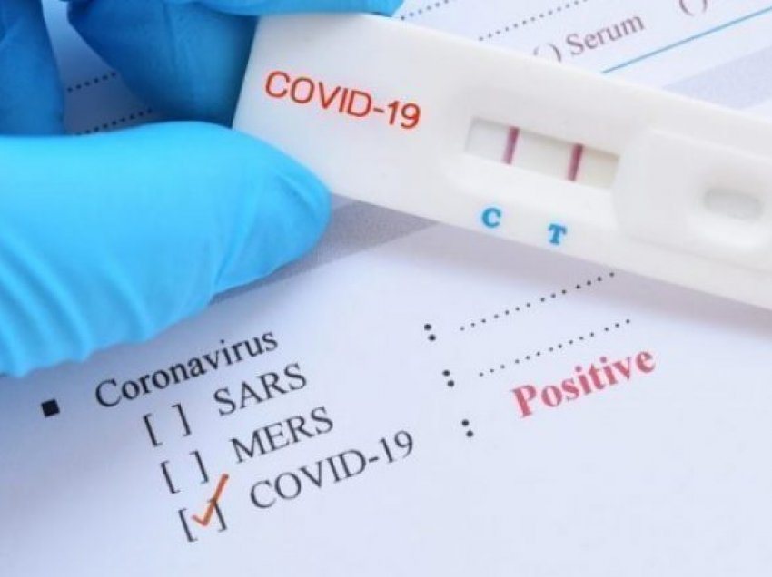 601 raste të reja me koronavirus në Maqedoni