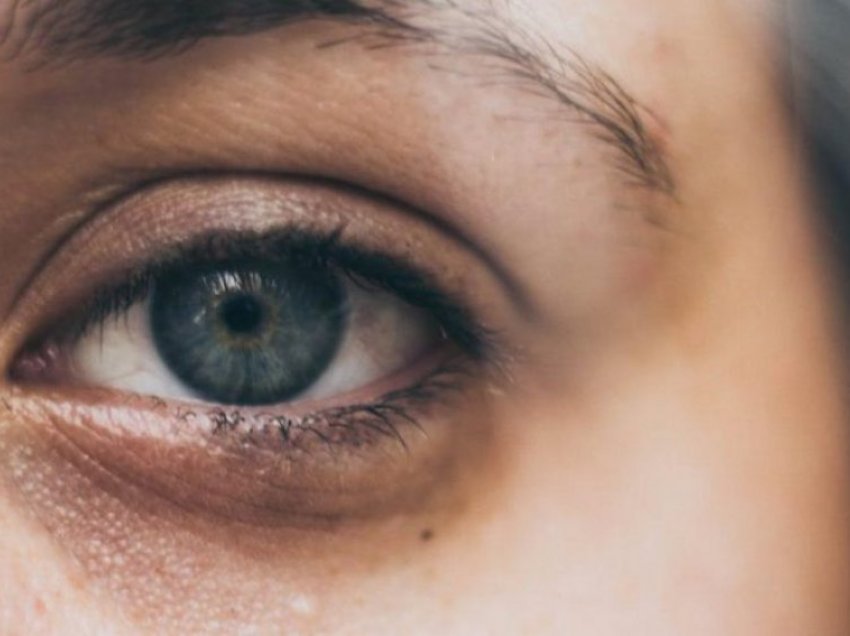 Nga çka shkaktohen rrathët e zinjë në sy?