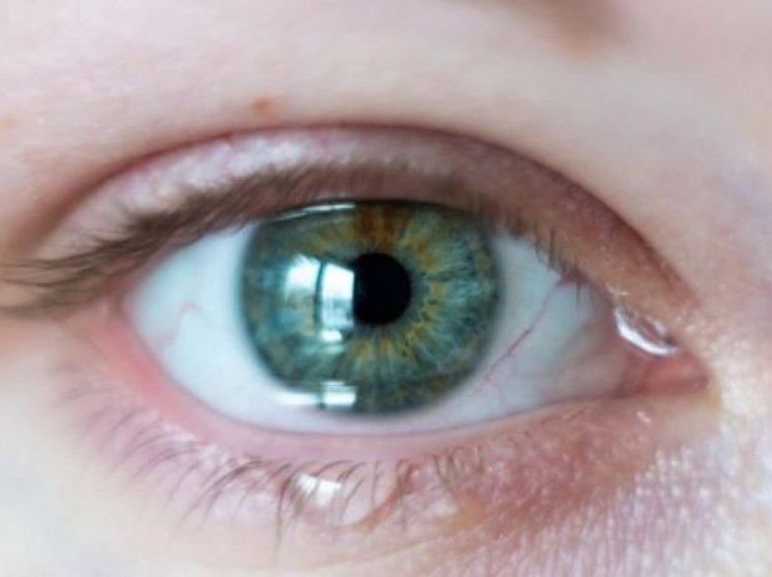 Ja faktorët që ndikojnë në lotimin e syve 