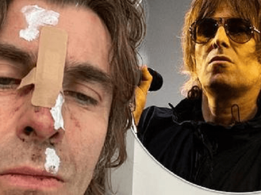 Liam Gallagher ‘bie me kokë’ nga helikopteri pas koncertit në ishull 