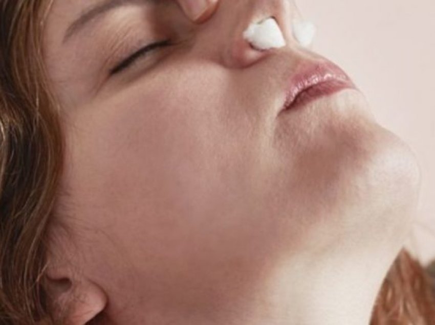 Çfarë e shkakton gjakderdhjen nga hunda? Mësoni se si ta ndaloni atë