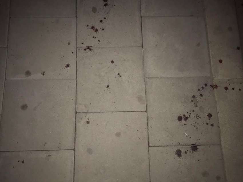 Detaje nga incidenti i mbrëmshëm në Prishtinë: Një person u therr me thikë