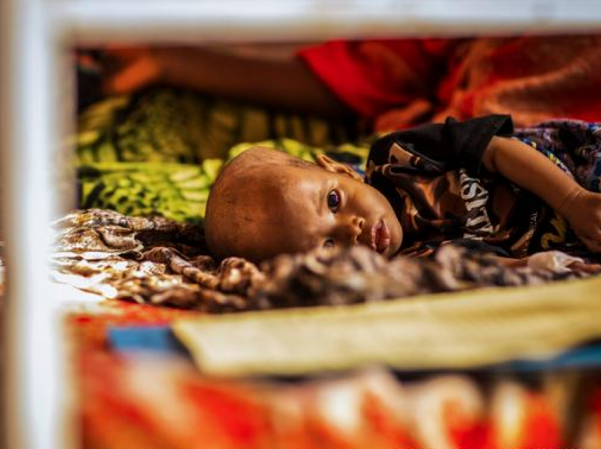 Mbi 2 milionë fëmijë në rrezik vdekje nga uria në Afrikë