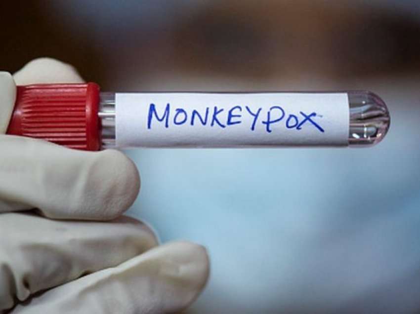 Lija e Majmunit: India konfirmon vdekjen e parë