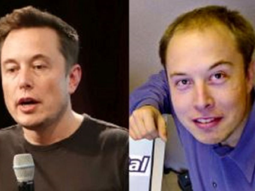 Zbulohen operacionet plastike të Elon Musk