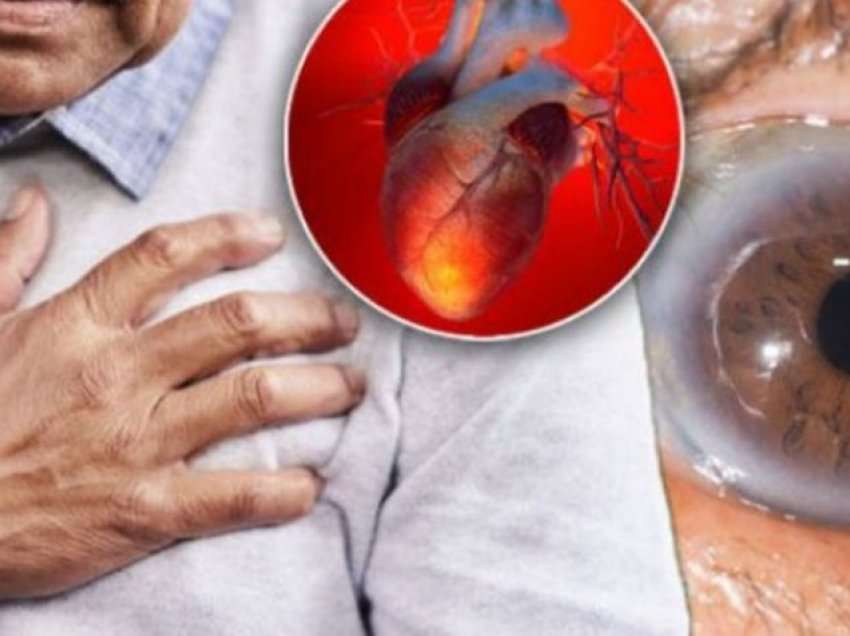 Sulmi në zemër, kjo pjesë e trupit zbulon rrezikun që iu kanoset 12 muaj më parë