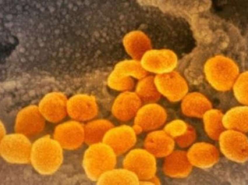 ​Që nga fillimi i pandemisë, 289.7 milionë njerëz janë infektuar me COVID-19