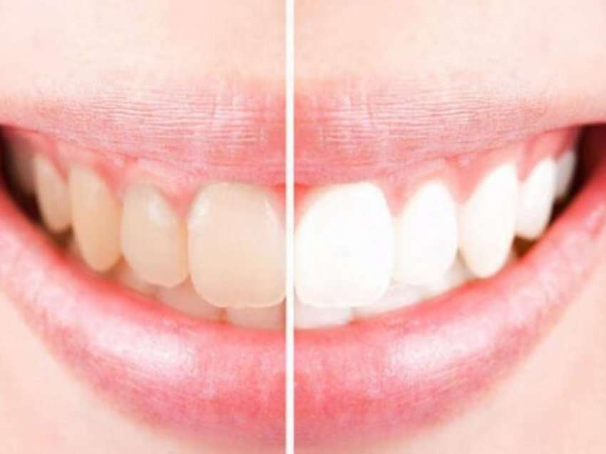 Ja si ti bëni dhëmbët tuaj të bardhë me një metodë shumë efikase