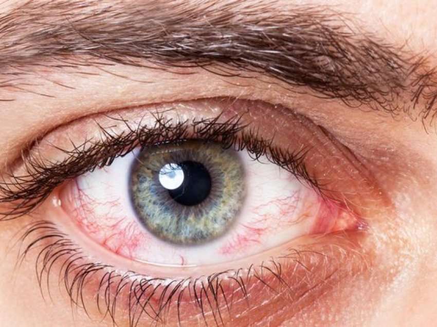 Ç’tregon ngjyra e syve për shëndetin tuaj?