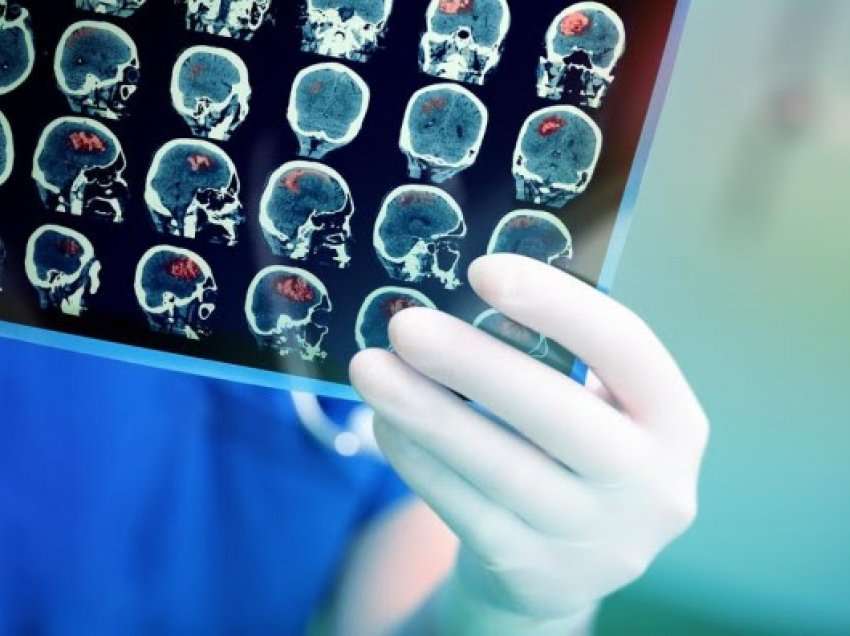 ​Kur dhimbja e kokës sinjalizon një tumor në tru?