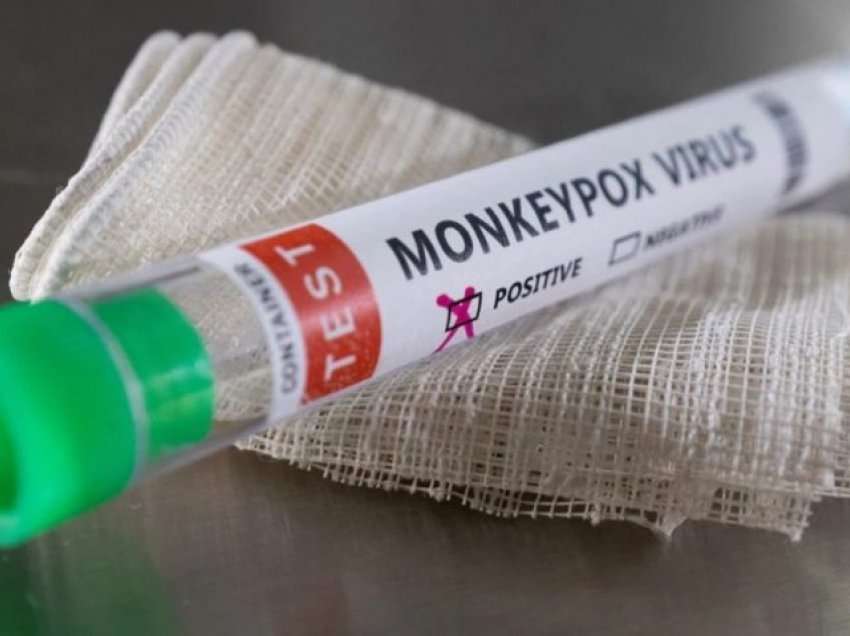 Mostrat e pacientit që dyshohet për lijën e majmunëve dërgohen për testim në Holandë