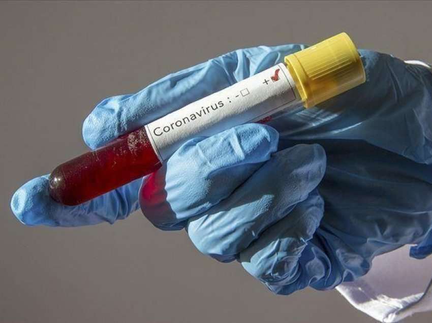 52 raste aktive me coronavirus në Kosovë
