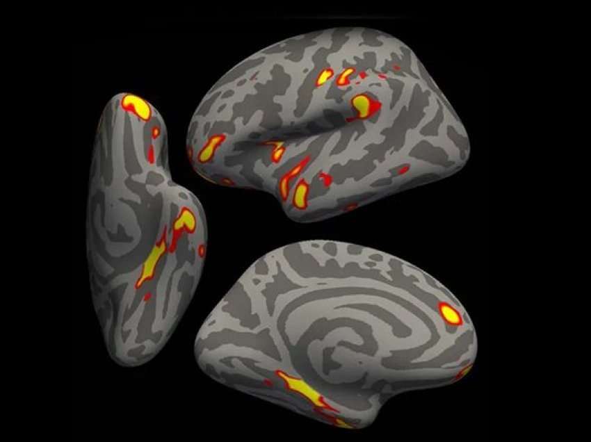 Studimi i ri: Të prekurit me COVID-19, mund të kenë përshpejtuar plakjen e trurit dhe ndryshime të tjera në të