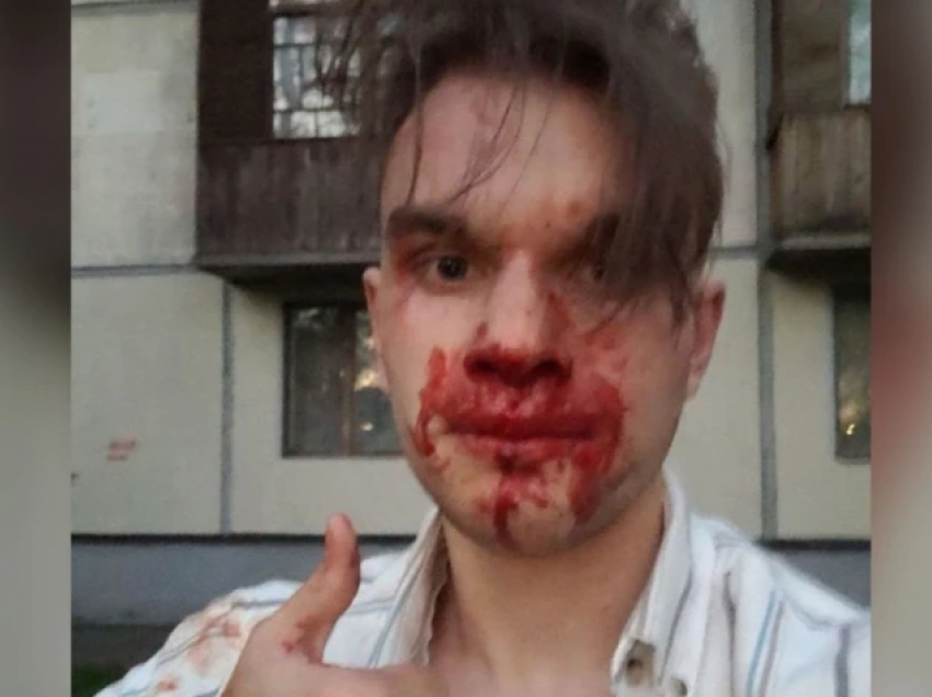 Sulmohet gazetari opozitar rus në Shën Petersburg