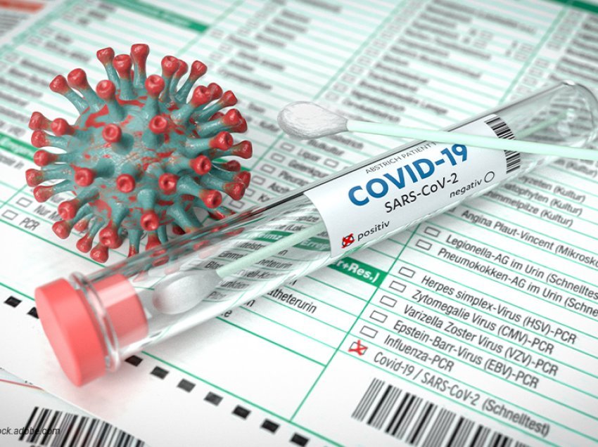 Situata e Covid19/ MSh: 18 qytetarë të infektuar dhe 18 të shëruar në 24 orët e fundit