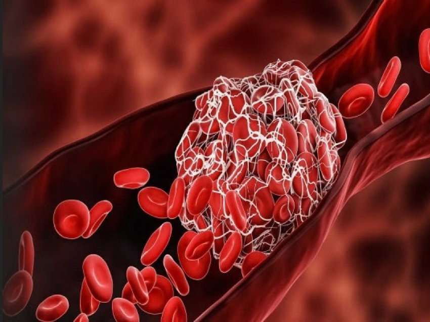 ​Hulumtimet kanë treguar se cili grup gjaku është më rezistues ndaj të gjitha sëmundjeve