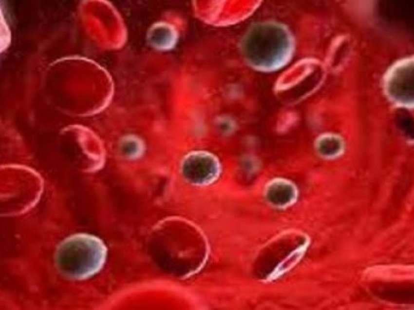 ​Grupi i gjakut ndikon në rrezikun e goditjes së hershme në tru