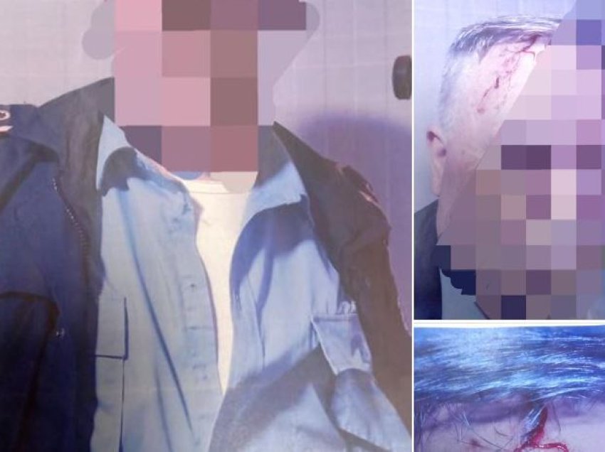 Një polic i Kosovës sulmohet nga një serb në Jarinje - këto janë detajet e para