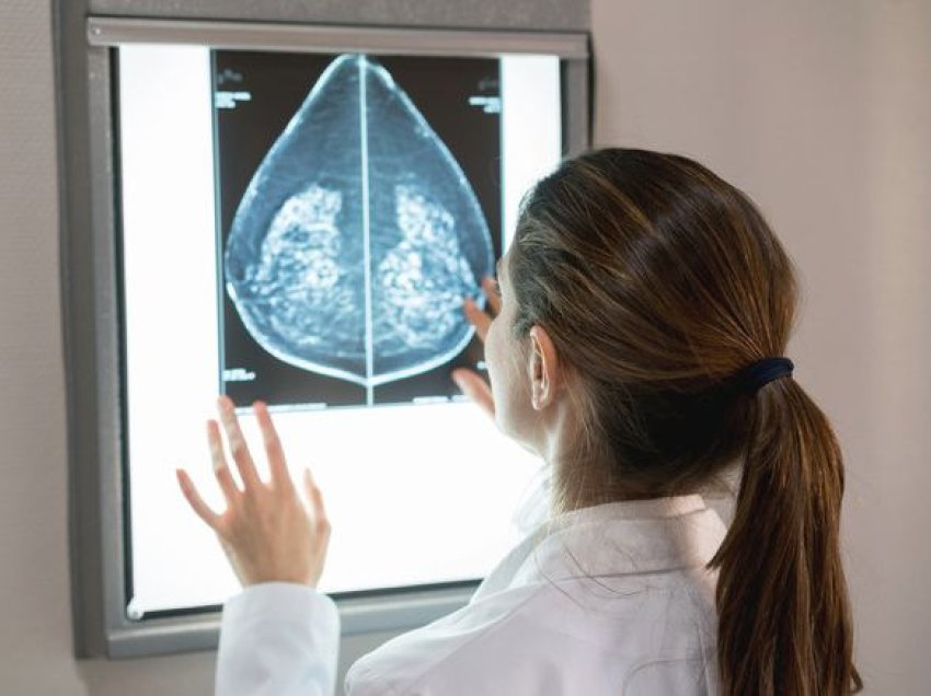Kanceri i gjirit, pas 5 vitesh 1 milion gra do të shohin nga e ardhmja