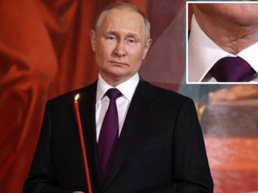 Imazhet e fundit thuhet se dëshmojnë që Putin ka kryer një operacion për kancer