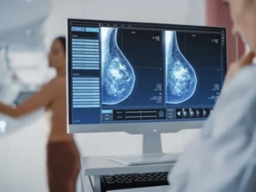 Inteligjenca artificiale zbuloi kancerin e gjirit para se dy mjekë të bënin mamografinë